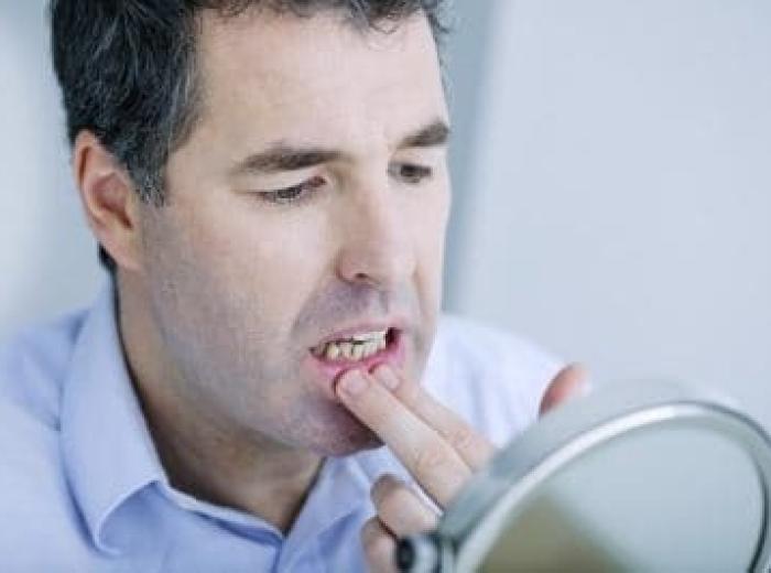 “Why Do My Gums Hurt?”