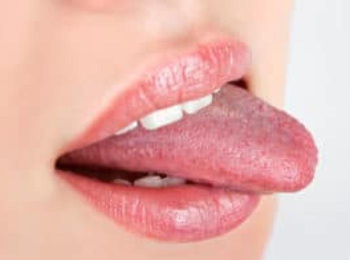What Your Tongue Can Say About Your Health