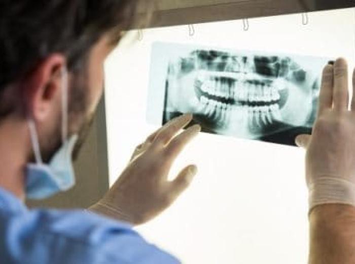 What Do Dental X-Rays Show?