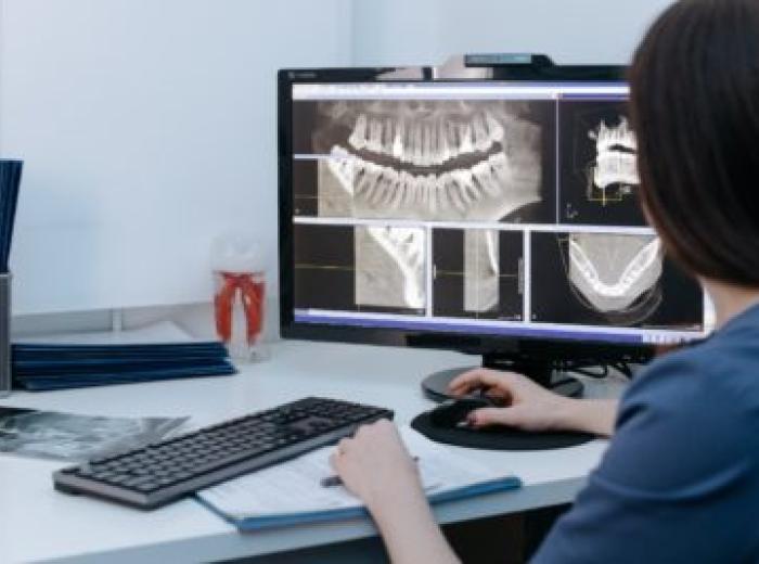How Much Radiation Is In Dental X-Rays?