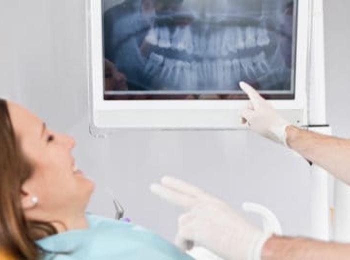 Your Guide to Becoming a Dental X-Rays Know-it-All