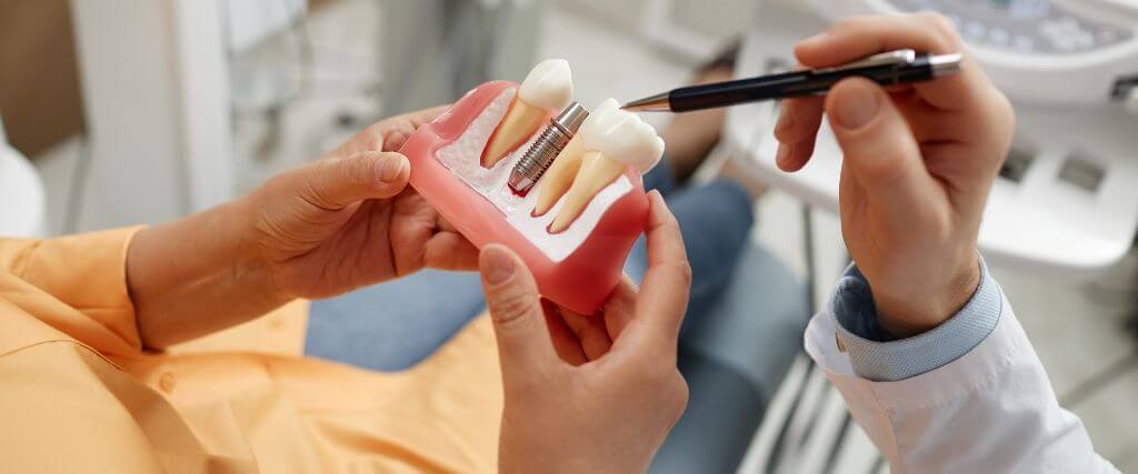 Dentures vs. Implants: Exploring Options for Full Arch Restoration