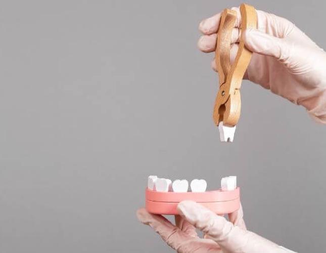 Do You Need a Bone Graft After a Tooth Extraction? What You Need to Know