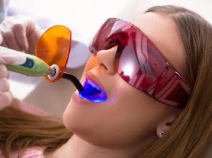 Dental Filling Fell Out? Don’t Panic. Read This!
